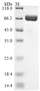 Recombinant Macaca mulatta Neurofilament light polypeptide(NEFL)