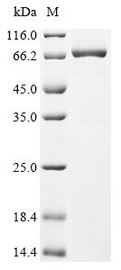 Recombinant Human cytomegalovirus Immediate early protein IE1 (UL123)
