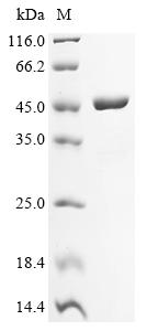 Recombinant Francisella tularensis subsp. novicida Succinyl-CoA ligase [ADP-forming] subunit beta (sucC)