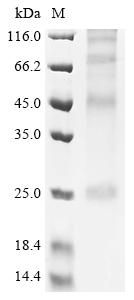 Recombinant Mouse Secretory carrier-associated membrane protein 4 (Scamp4)