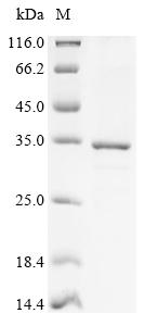 Recombinant Human Mitochondrial thiamine pyrophosphate carrier (SLC25A19)