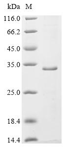 Recombinant Rat Synaptogyrin-1 (Syngr1)