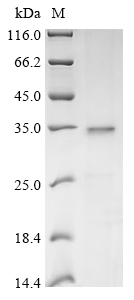 Recombinant Rat Synaptophysin (Syp)