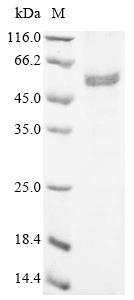 Recombinant Human Scaffold protein ILK (ILK)