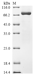 Recombinant Human DNA topoisomerase 1 (TOP1), partial
