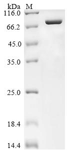 Recombinant Human DNA topoisomerase 1 (TOP1), partial