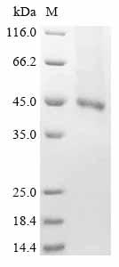 Recombinant Human Receptor-type tyrosine-protein kinase FLT3 (FLT3), partial