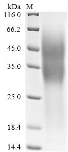 Recombinant Human Tumor necrosis factor receptor superfamily member 10D (TNFRSF10D), partial