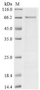 Recombinant Human SET and MYND domain-containing protein 3 (SMYD3)