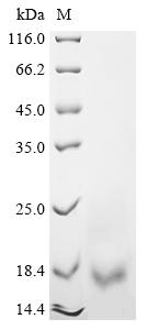 Recombinant Rat Vesicular glutamate transporter 2 (Slc17a6), partial