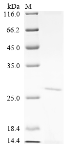 Recombinant Human 5' (3')-deoxyribonucleotidase, cytosolic type (NT5C)
