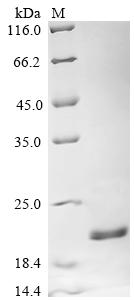 Recombinant Legionella pneumophila Peptidoglycan-associated lipoprotein (pal)