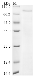 Recombinant Human Novel Coronavirus Nucleoprotein (N) (P13L,Δ31-33,R203K,G204R)