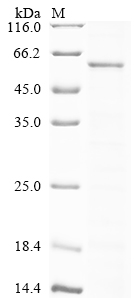 Recombinant Rabies virus Nucleoprotein (N)