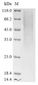Recombinant Mouse Transmembrane protein 106B (Tmem106b), partial