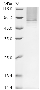 Recombinant Human Serpin B10 (SERPINB10)