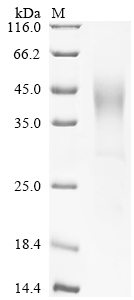 Recombinant Human Glucose-6-phosphatase catalytic subunit 1 (G6PC1), partial