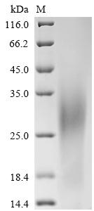 Recombinant Human Glucose-6-phosphatase catalytic subunit 1 (G6PC1), partial