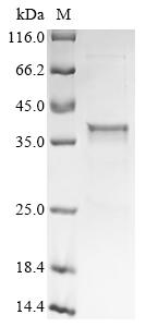 Recombinant Mouse Ectonucleotide pyrophosphatase/phosphodiesterase family member 1 (Enpp1), partial