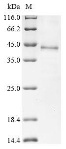 Recombinant Human Dipeptidase 1 (DPEP1)