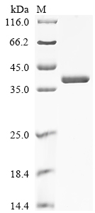 Recombinant Mouse Annexin A2 (Anxa2)