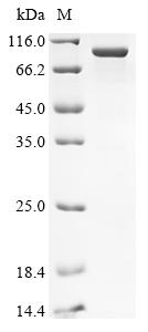 Recombinant Human Ubiquitin thioesterase ZRANB1 (ZRANB1)