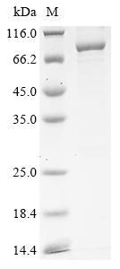Recombinant Human Nuclear pore complex protein Nup85 (NUP85)