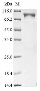 Recombinant Human ATP-dependent RNA helicase DDX1 (DDX1)