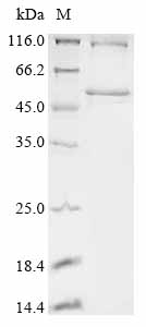 Recombinant Human Ankyrin repeat and SOCS box protein 11 (ASB11)