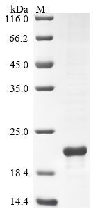 Recombinant Human Urocortin-3 (UCN3)