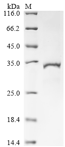 Recombinant Human Estradiol 17-beta-dehydrogenase 11 (HSD17B11)