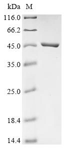 Recombinant Chicken Indian hedgehog protein (IHH)