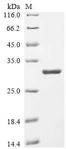 Recombinant Human 5' (3')-deoxyribonucleotidase, cytosolic type (NT5C)