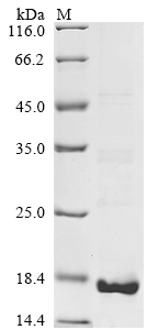 Recombinant Mouse Isoleucine--tRNA ligase,cytoplasmic (Iars1), partial