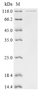 Recombinant Human Mitochondrial antiviral-signaling protein (MAVS), partial, Biotinylated