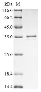Recombinant Human Ras-related protein Rab-12 (RAB12)