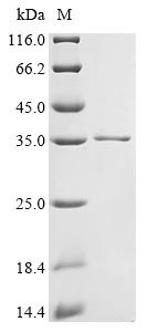 Recombinant Human Protein GPR107 (GPR107), partial