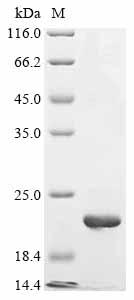 Recombinant Mouse Fanconi-associated nuclease 1 (Fan1), partial