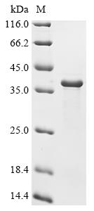 Recombinant Rabbit Methylosome subunit pICln (CLNS1A)