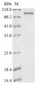 Recombinant Human Cullin-3 (CUL3)