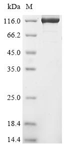 Recombinant Human Origin recognition complex subunit 1 (ORC1)