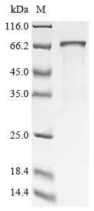 Recombinant Human Calcium/calmodulin-dependent protein kinase type II subunit delta (CAMK2D)