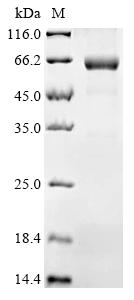 Recombinant Human Calcium/calmodulin-dependent protein kinase type II subunit delta (CAMK2D)