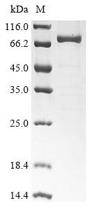 Recombinant Human High affinity cGMP-specific 3’,5’-cyclic phosphodiesterase 9A (PDE9A)