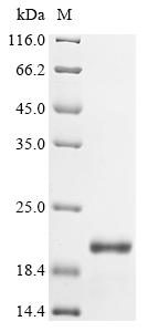 Recombinant Human immunodeficiency virus 1 Protein Rev (rev) (D62T,T68A)