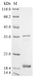 Recombinant Human immunodeficiency virus 1 Protein Rev (rev) (P93S,X94V)