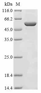 Recombinant Porphyromonas gingivalis Cell division protein FtsZ (ftsZ)