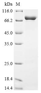 Recombinant Toxoplasma gondii Heat shock protein HSP70 (HSP70)