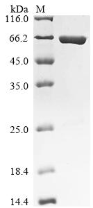 Recombinant Escherichia coli O6:H1 UPF0304 protein yfbU (yfbU), Biotinylated