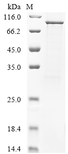 Recombinant Human papillomavirus type 18 Major capsid protein L1 (L1)